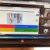 Відкрите лекційне заняття з теми «Патологічна фізіологія периферичного кровообігу»